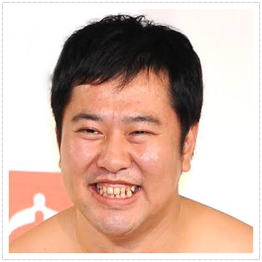 とにかく明るい安村
