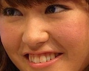 桐谷美玲、肌荒れ、ほんまでっか